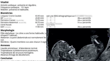 Appel Urgent. On veut sauver ce bébé de l'Avortement.