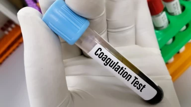 La coagulation sanguine témoin du dessein divin