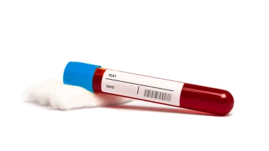 Nétilat Yadaïm après chaque analyse glycémique ou prise de sang ?